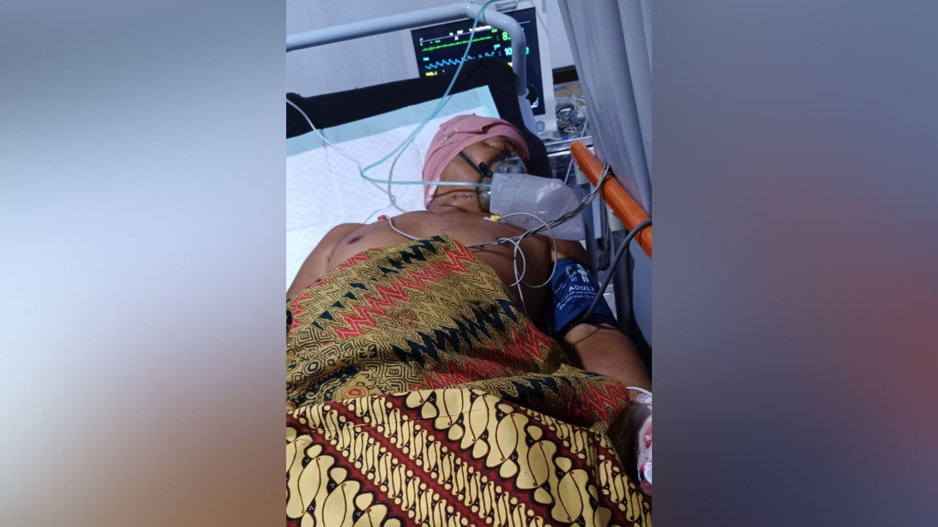 Darmawi Korban Pengeroyokan Brutal di Banyuasin