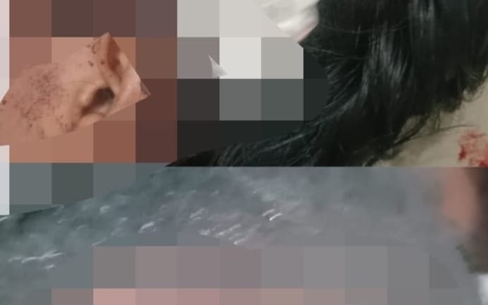 Polsek Jati Agung Kurang Represif Terhadap Pengeroyokan Anak Dibawah Umur